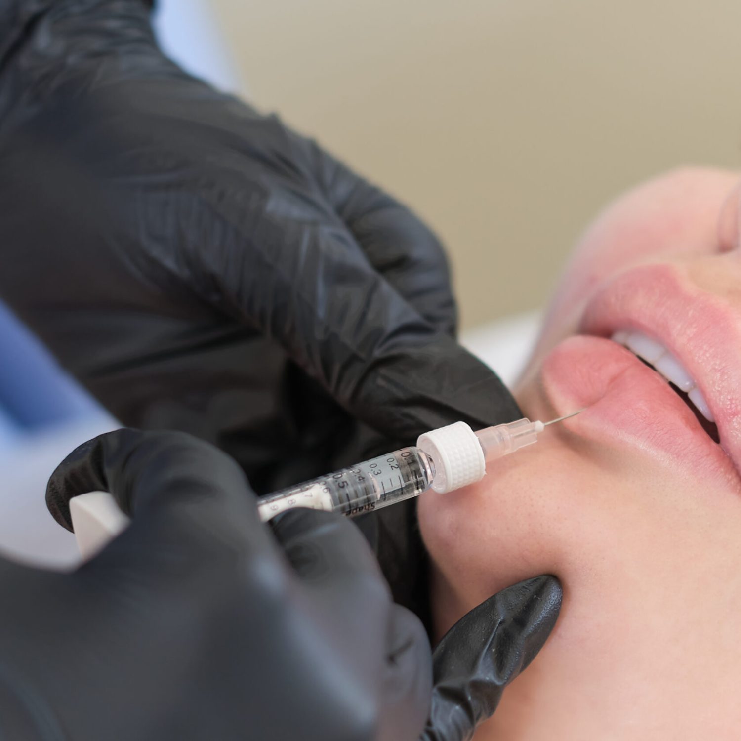 A cosmetologist carefully injects a client's lips. Enhancements come with both benefits and risks