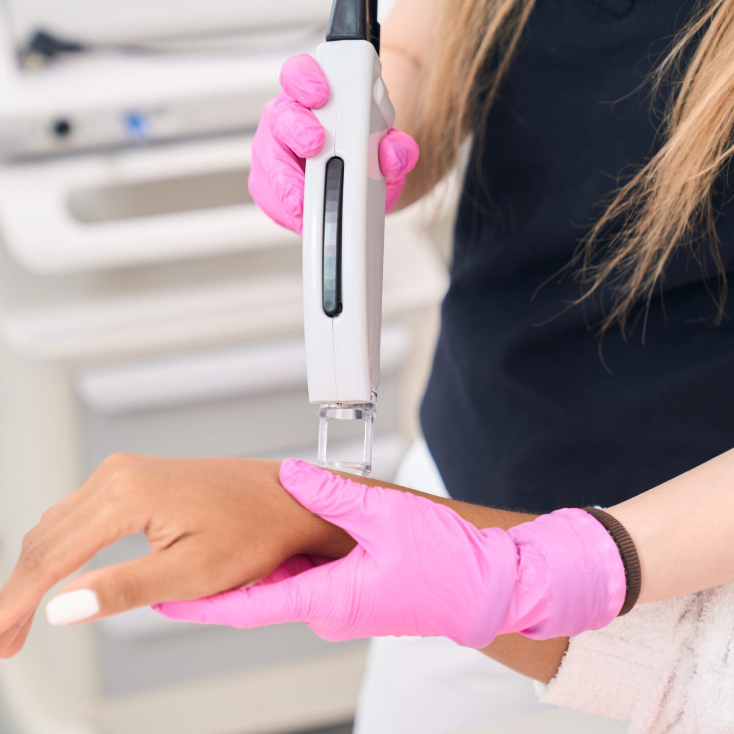 Highly effective, painless procedure for laser hair removal of the hands in a modern aesthetic medicine center